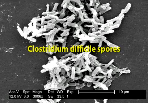 uv-cleaning-in-hosptials-and-c-diff